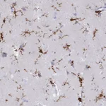 Atlas Antibodies Anti-AIF1 Antibody