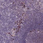 Atlas Antibodies Anti-LTB Antibody