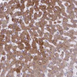 Atlas Antibodies Anti-AIG1 Antibody