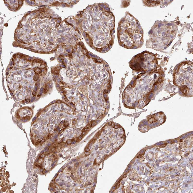 Atlas Antibodies Anti-AIM1 Antibody