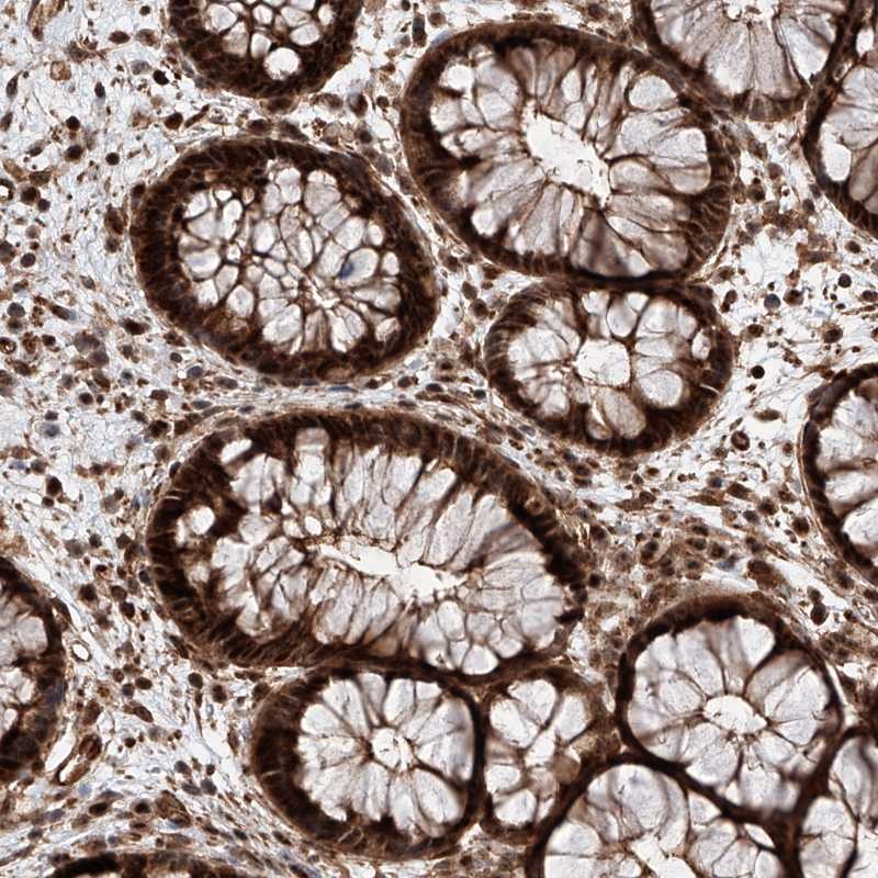 Atlas Antibodies Anti-AIM1L Antibody