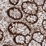 Atlas Antibodies Anti-AIM1L Antibody