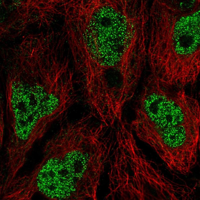 Atlas Antibodies Anti-AIM1L Antibody