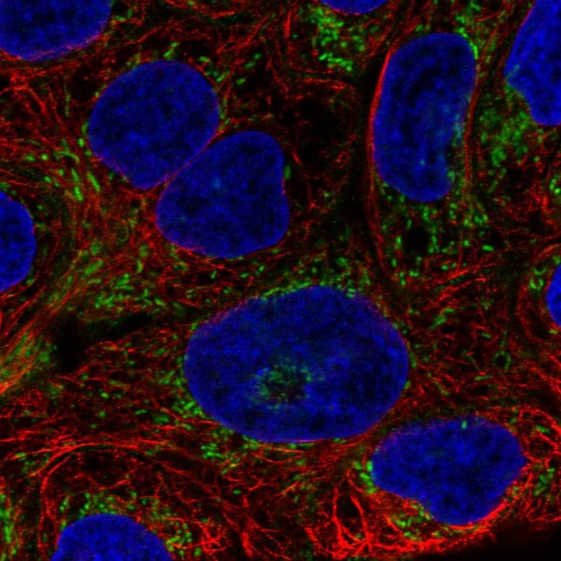 Atlas Antibodies Anti-AIM2 Antibody