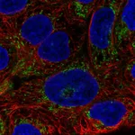 Atlas Antibodies Anti-AIM2 Antibody