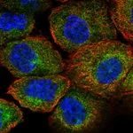 Atlas Antibodies Anti-AIP Antibody