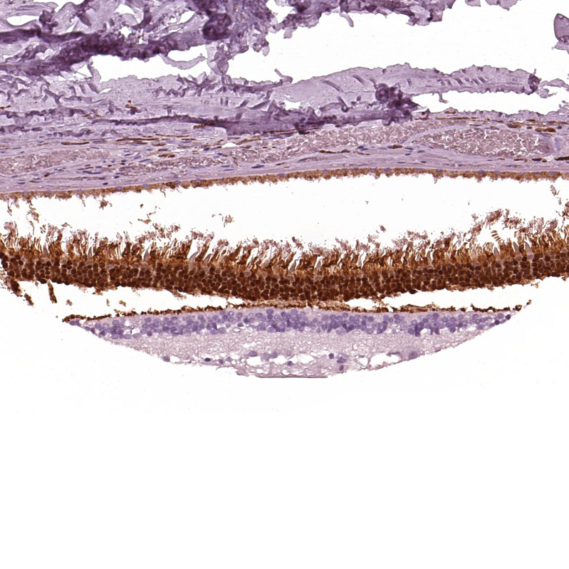 Atlas Antibodies Anti-AIPL1 Antibody