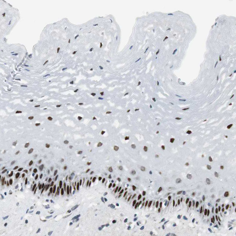 Atlas Antibodies Anti-AJUBA Antibody