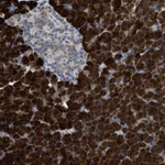 Atlas Antibodies Anti-AK2 Antibody