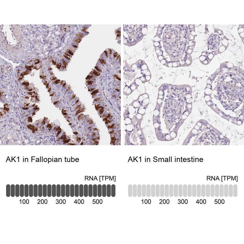 Atlas Antibodies Anti-AK1 Antibody