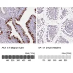 Atlas Antibodies Anti-AK1 Antibody