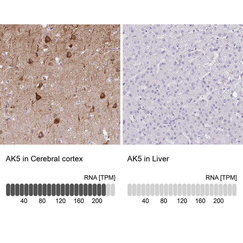 Atlas Antibodies Anti-AK5 Antibody