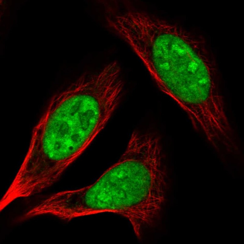 Atlas Antibodies Anti-AK6 Antibody