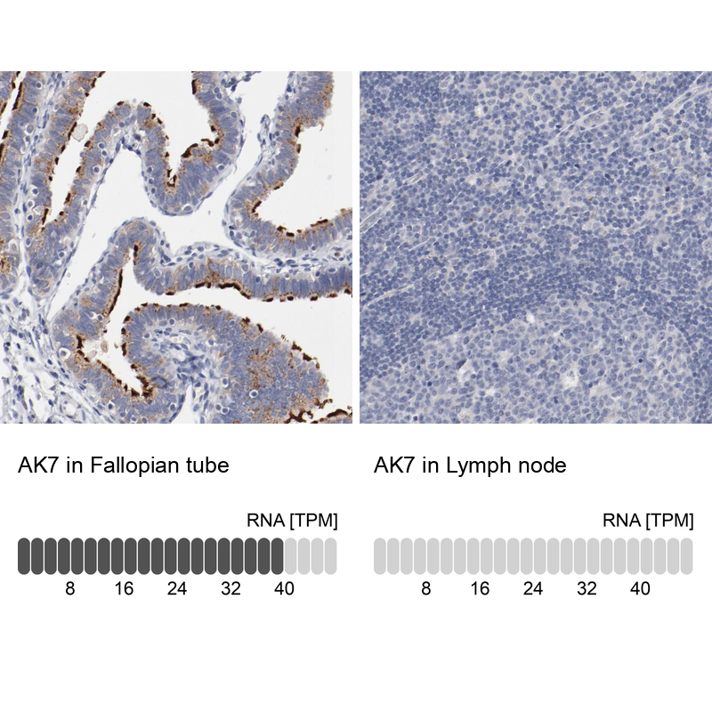 Atlas Antibodies Anti-AK7 Antibody