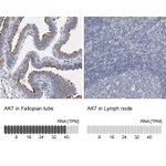 Atlas Antibodies Anti-AK7 Antibody