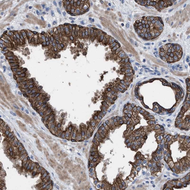 Atlas Antibodies Anti-AK8 Antibody