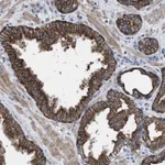 Atlas Antibodies Anti-AK8 Antibody