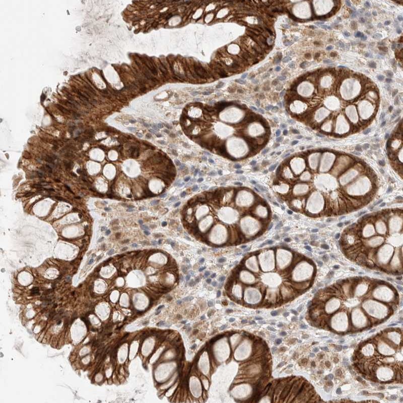Atlas Antibodies Anti-AK8 Antibody