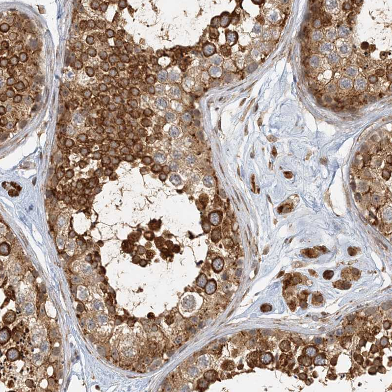 Atlas Antibodies Anti-AK9 Antibody