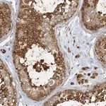Atlas Antibodies Anti-AK9 Antibody
