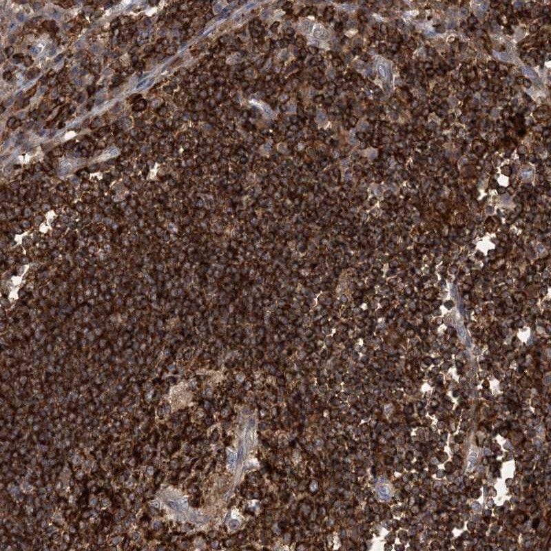Atlas Antibodies Anti-AK9 Antibody