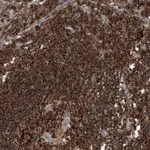 Atlas Antibodies Anti-AK9 Antibody