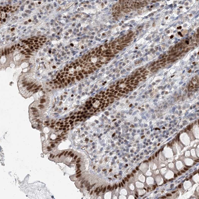 Atlas Antibodies Anti-AK9 Antibody
