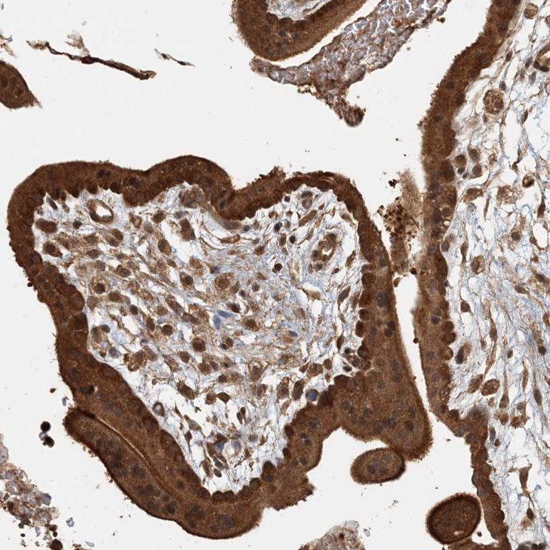 Atlas Antibodies Anti-AK9 Antibody