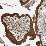 Atlas Antibodies Anti-AK9 Antibody