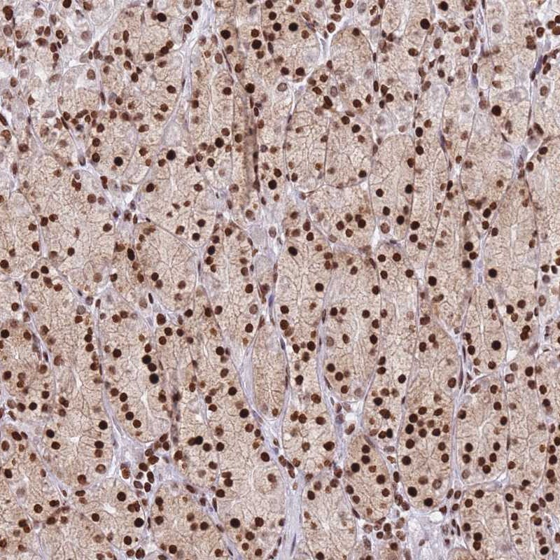 Atlas Antibodies Anti-AK9 Antibody