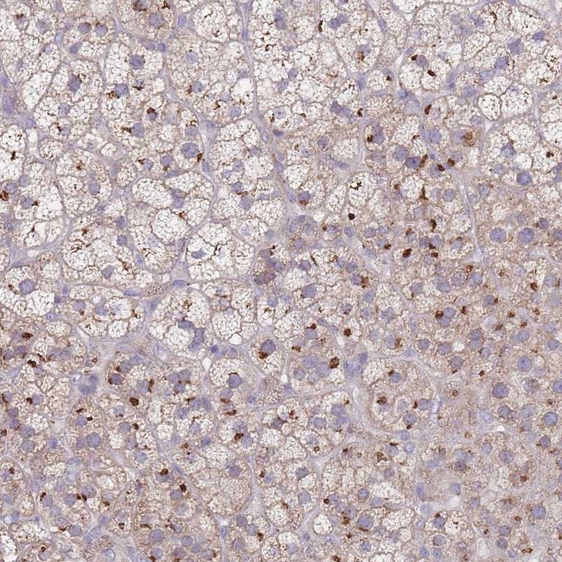 Atlas Antibodies Anti-AKAIN1 Antibody
