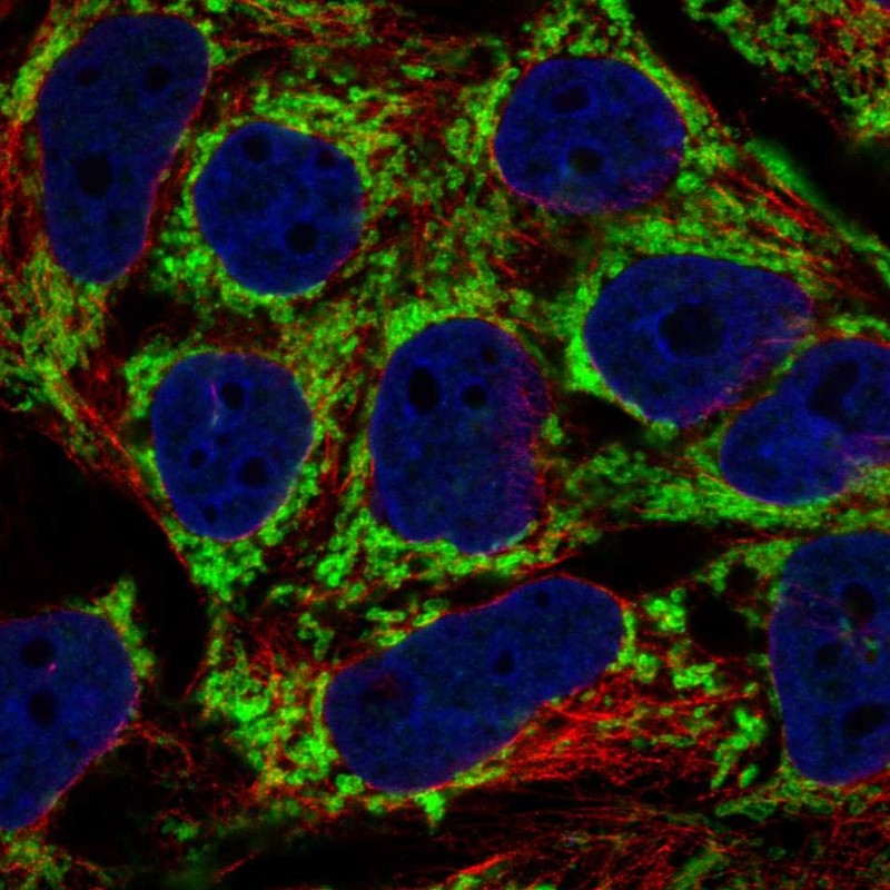 Atlas Antibodies Anti-AKAP1 Antibody