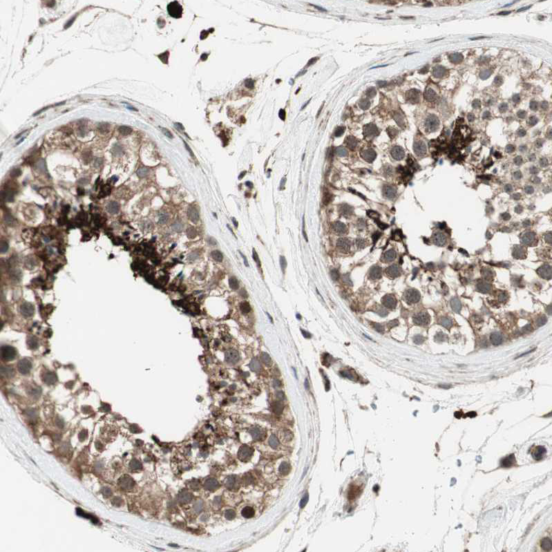 Atlas Antibodies Anti-AKAP1 Antibody
