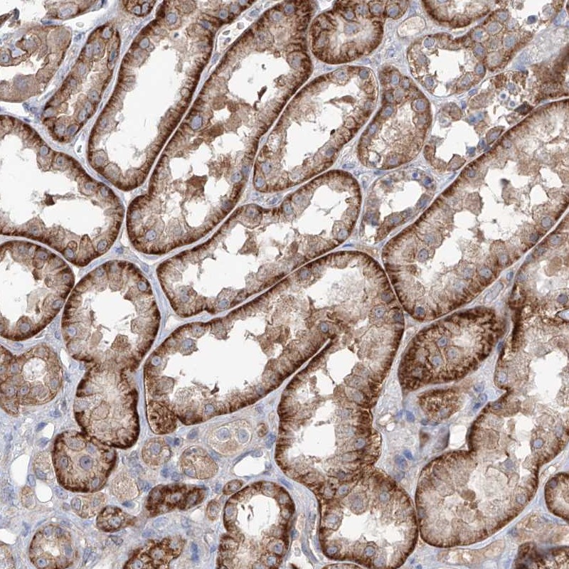 Atlas Antibodies Anti-AKAP10 Antibody