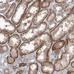 Atlas Antibodies Anti-AKAP10 Antibody