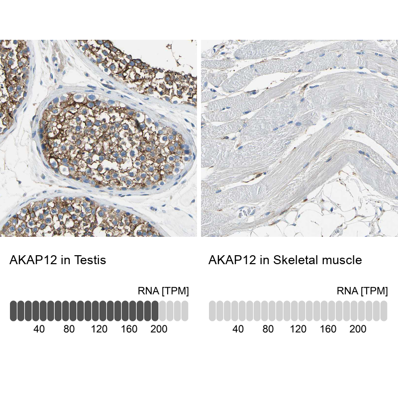 Atlas Antibodies Anti-AKAP12 Antibody