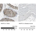 Atlas Antibodies Anti-AKAP12 Antibody