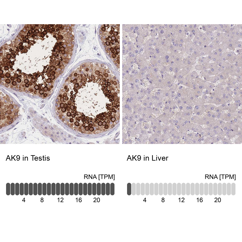 Atlas Antibodies Anti-AK9 Antibody