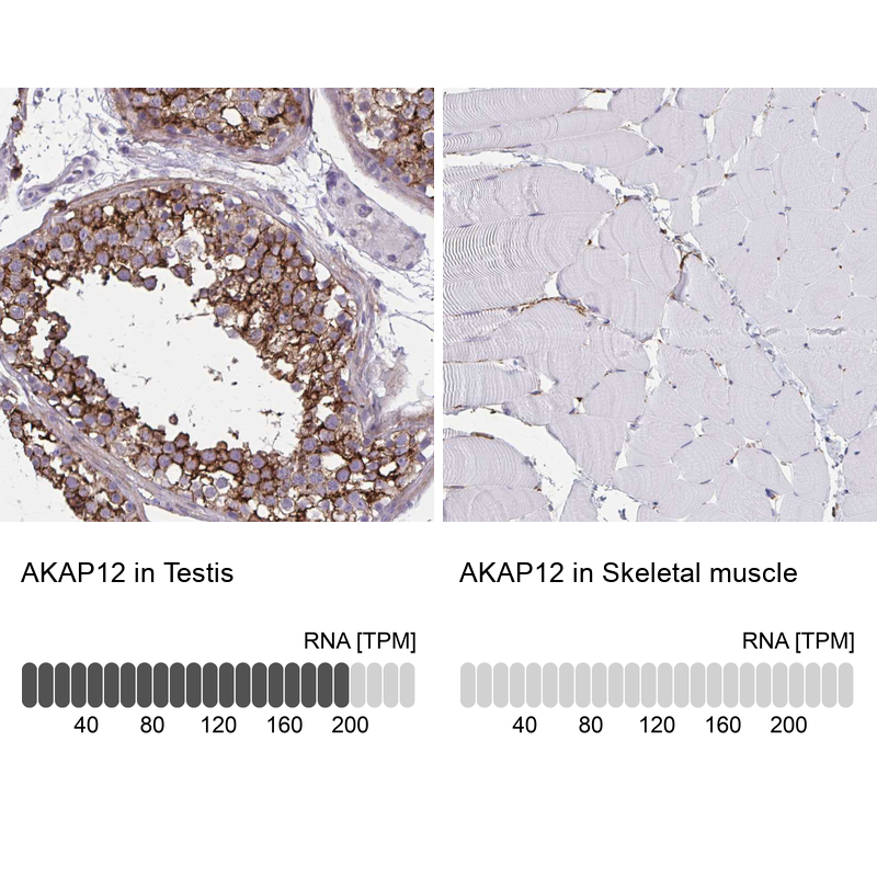 Atlas Antibodies Anti-AKAP12 Antibody