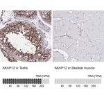 Atlas Antibodies Anti-AKAP12 Antibody