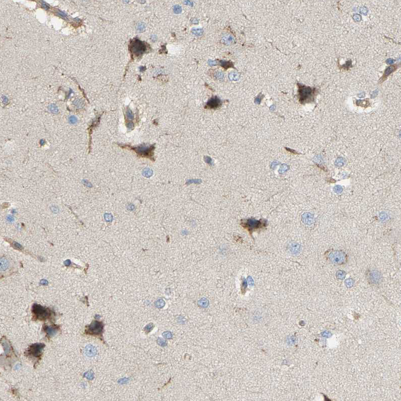 Atlas Antibodies Anti-AKAP13 Antibody
