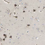 Atlas Antibodies Anti-AKAP13 Antibody