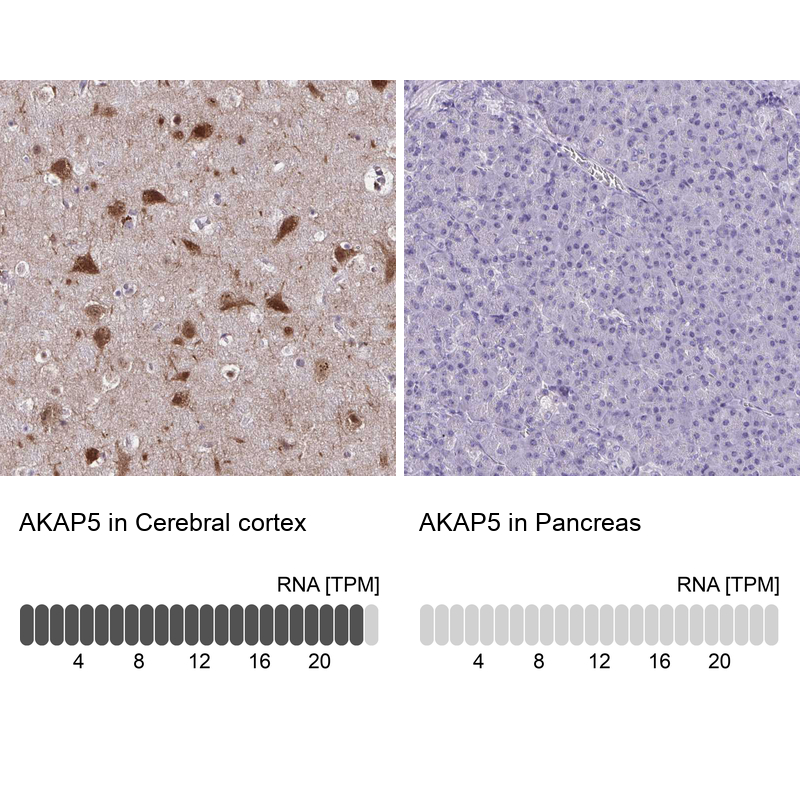 Atlas Antibodies Anti-AKAP5 Antibody