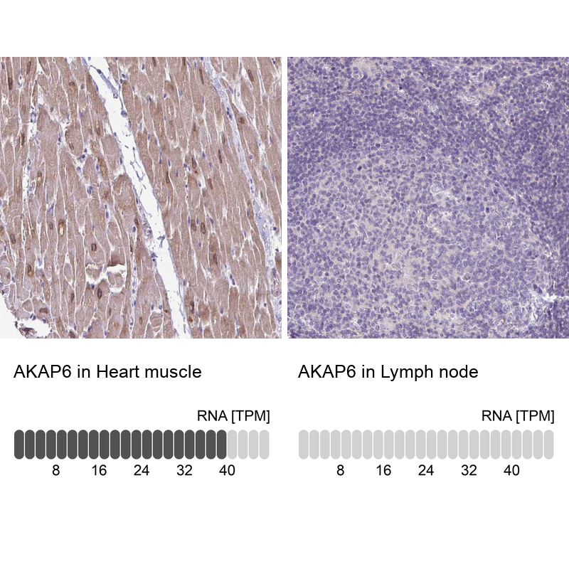 Atlas Antibodies Anti-AKAP6 Antibody
