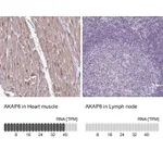 Atlas Antibodies Anti-AKAP6 Antibody