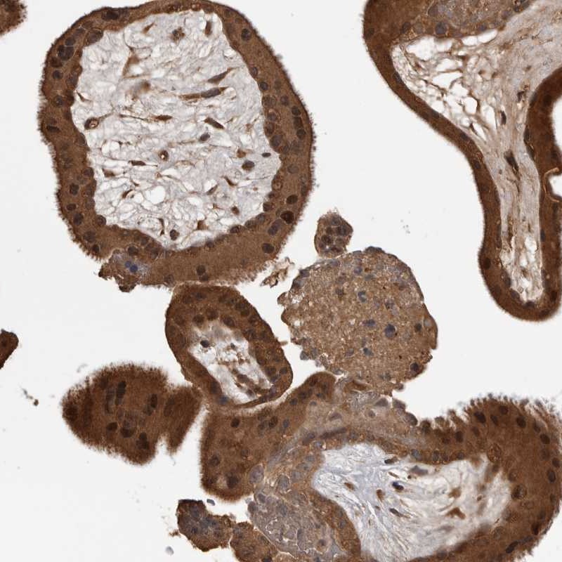 Atlas Antibodies Anti-AKAP7 Antibody