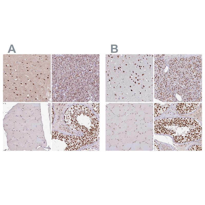 Atlas Antibodies Anti-AKAP8L Antibody