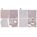 Atlas Antibodies Anti-AKAP8L Antibody