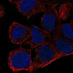 Atlas Antibodies Anti-AKAP7 Antibody