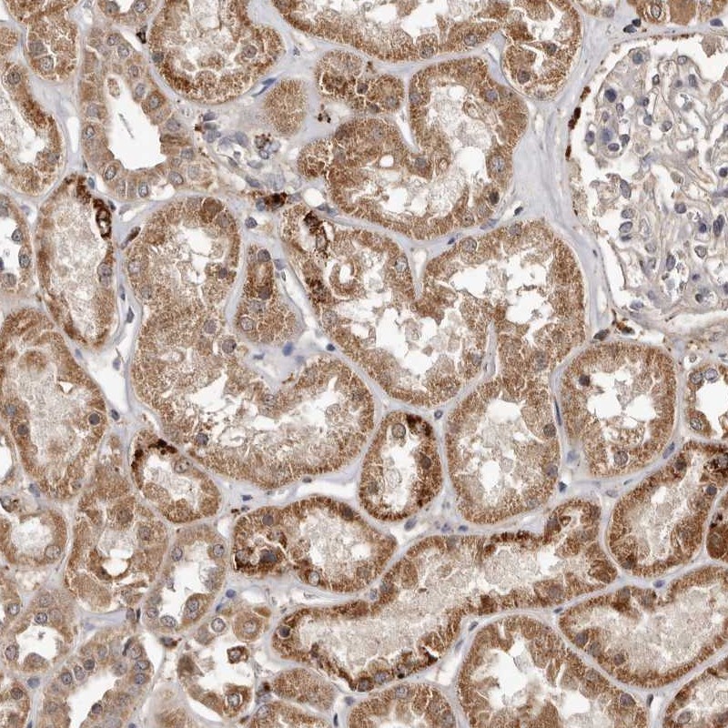 Atlas Antibodies Anti-AKAP7 Antibody